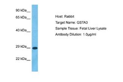 GSTA3 Rabbit anti-Human, Polyclonal, Novus Biologicals 0.1ml; Unconjugated:Antibodies,